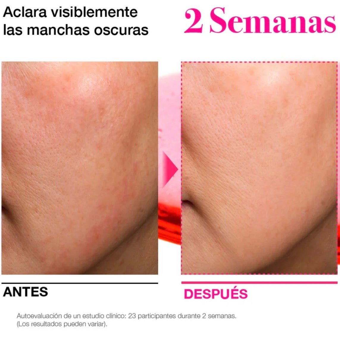 ANUA - Niacinamide 10% + TXA 4% Serum
