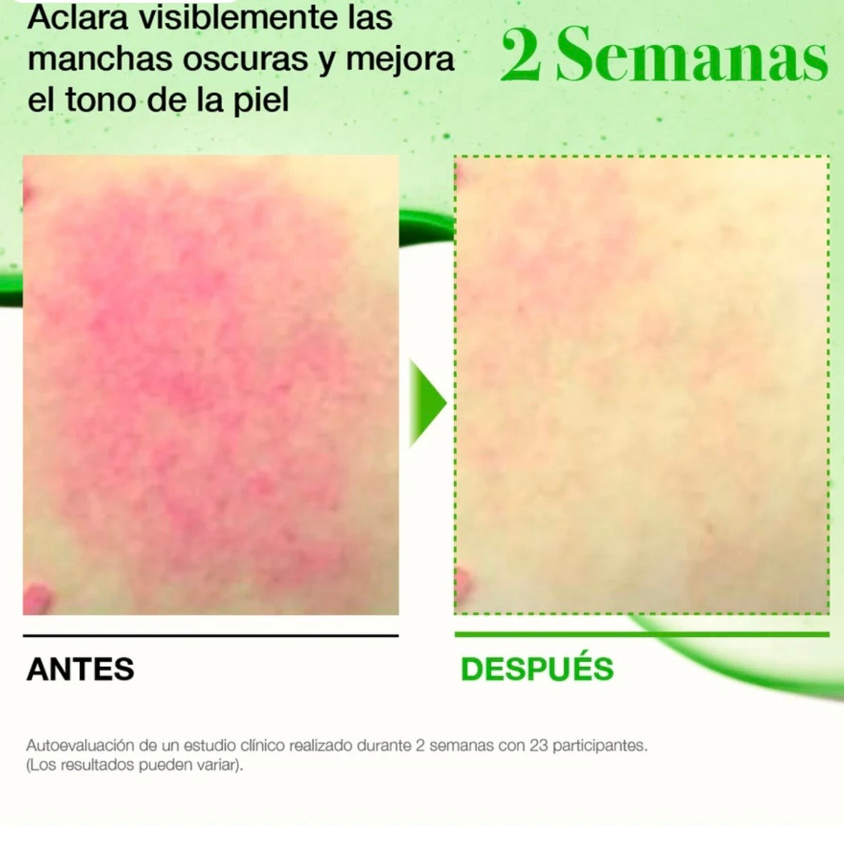 ANUA - Azelaic Acid 10 Hyaluron Redness Soothing